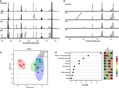 Metabolic Profile of Oral Squamous Carcinoma Cell Lines Relies on a Higher Demand of Lipid Metabolism in Metastatic Cells